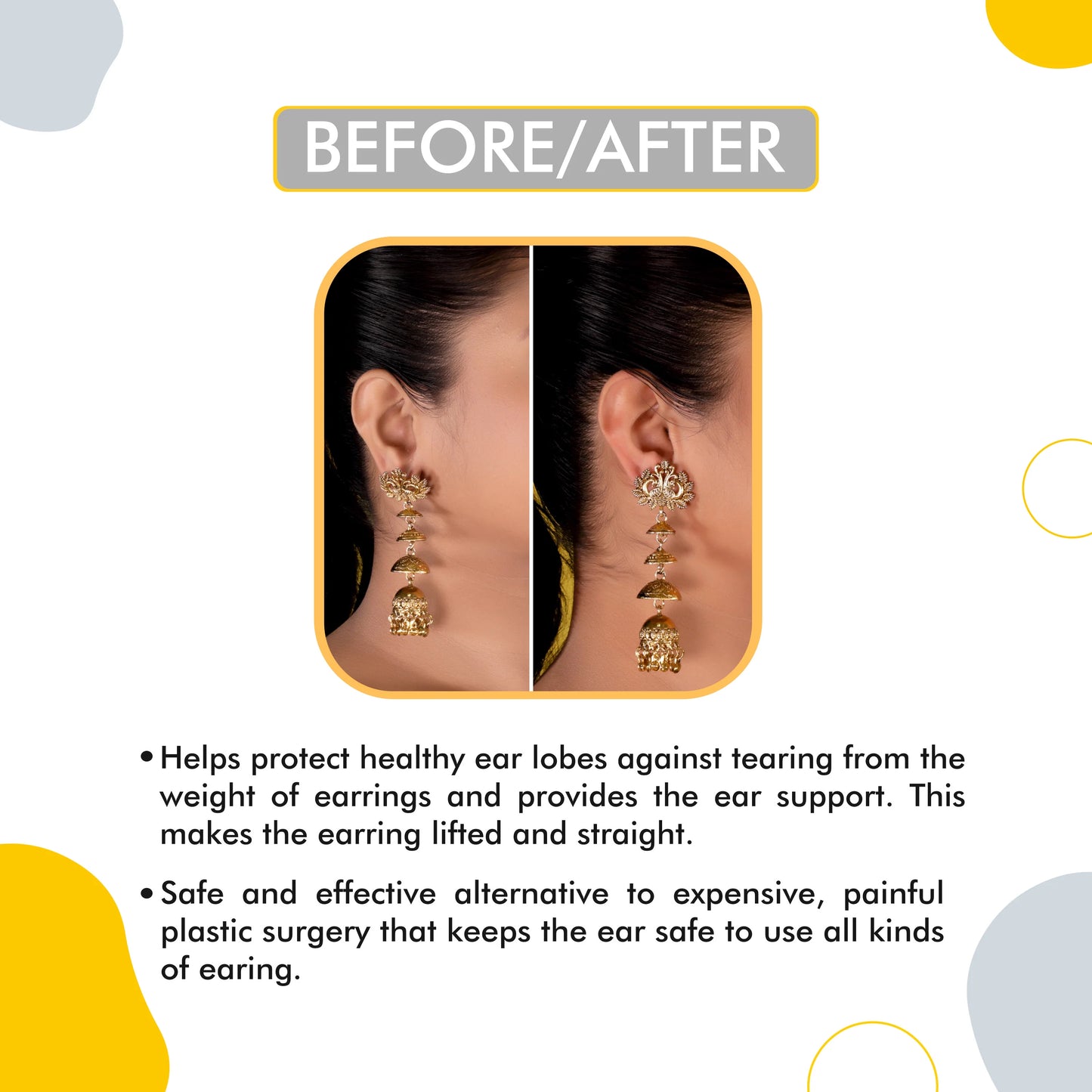 Ear Lobe Support Patches