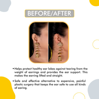 Ear Lobe Support Patches